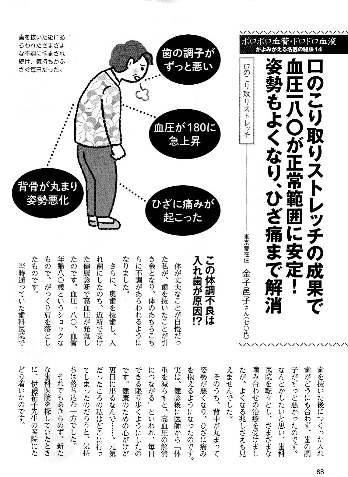 東京都・文京区の顎関節症・かみ合わせ治療専門医院｜グリーン歯科医院の口のコリ取りマッサージ・トレーニング